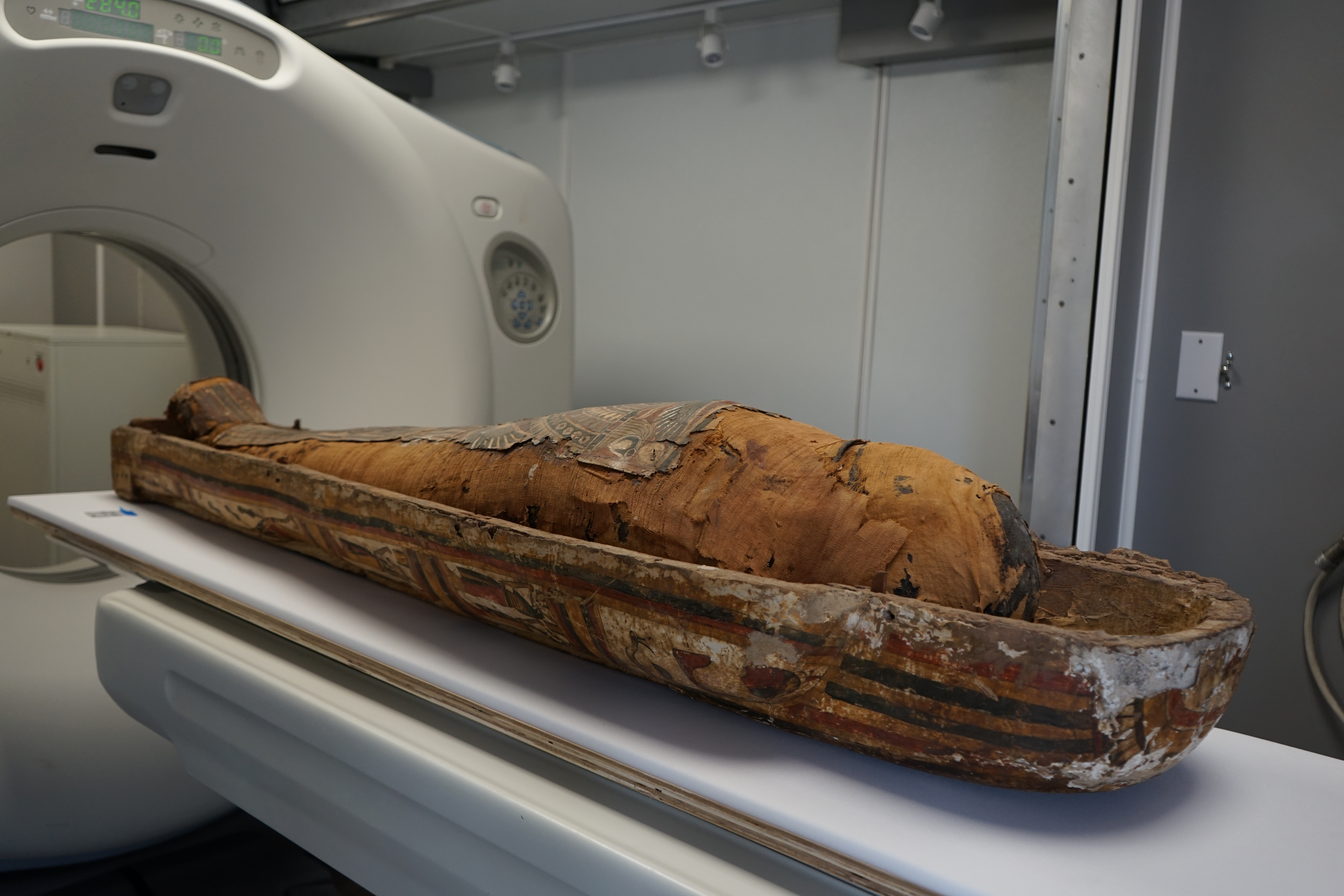 Mummy Scan