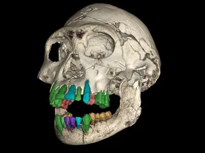 A 3D reconstruction of the fossil skull of a youth of an early&nbsp;Homo&nbsp;species from Dmanisi, Georgia. The green, orange and red colors represent the preserved teeth, while the blue represent missing ones and the purple teeth have not been recovered.