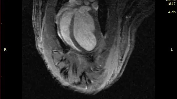 Preview thumbnail for Cardiac MRI of an animal that has undergone photosynthetic therapy